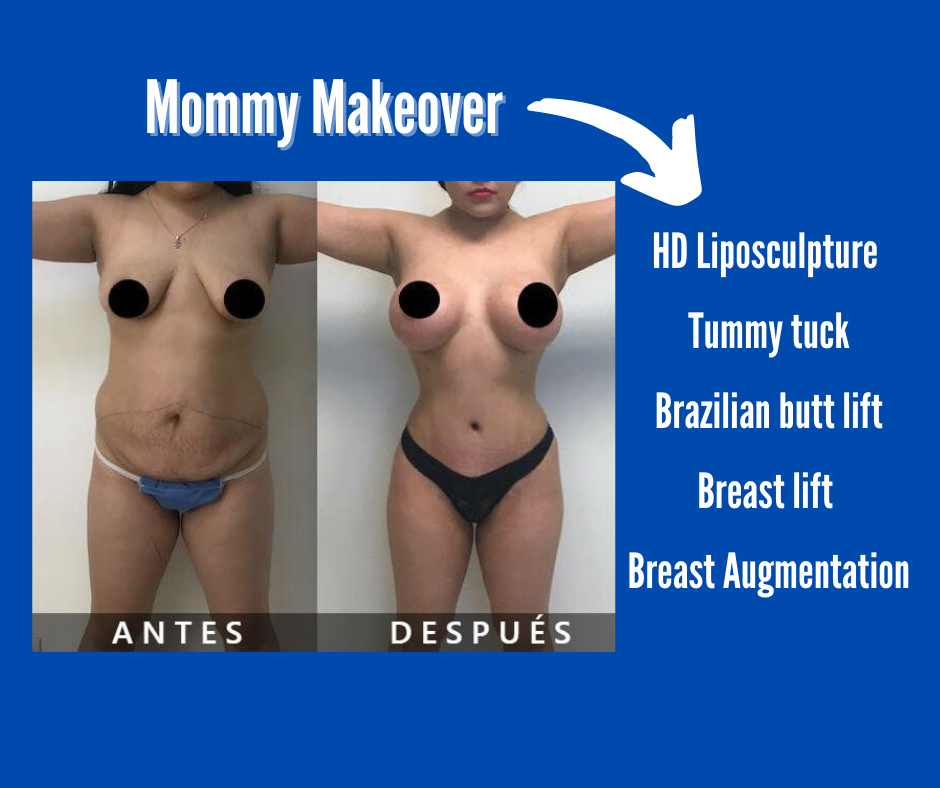 Mommy Makeover